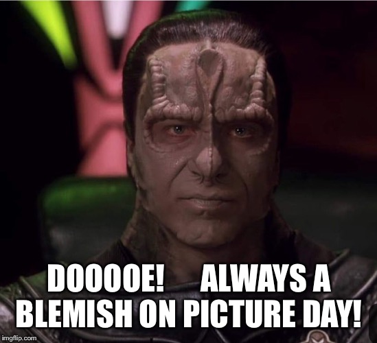 DOOOOE!      ALWAYS A
BLEMISH ON PICTURE DAY! | made w/ Imgflip meme maker