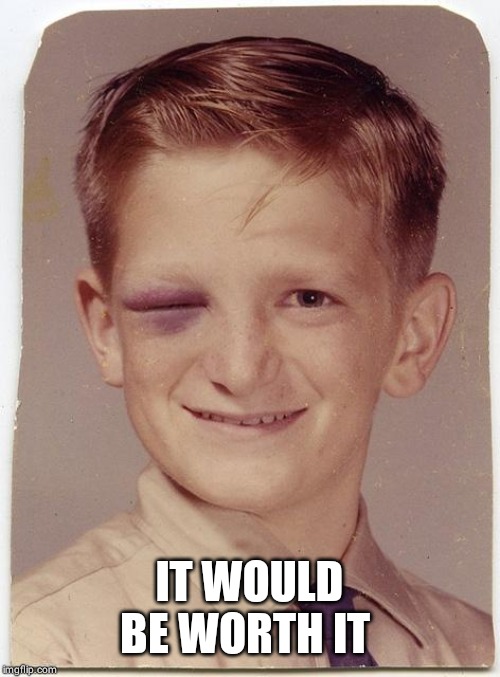 Black Eye Friday | IT WOULD BE WORTH IT | image tagged in black eye friday | made w/ Imgflip meme maker