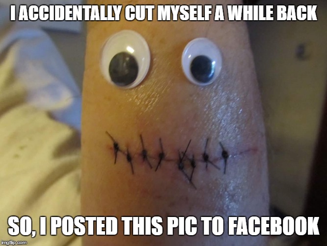 I ACCIDENTALLY CUT MYSELF A WHILE BACK SO, I POSTED THIS PIC TO FACEBOOK | made w/ Imgflip meme maker