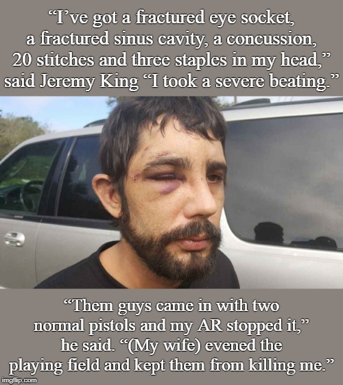 Pregnant wife saves the day. | “I’ve got a fractured eye socket, a fractured sinus cavity, a concussion, 20 stitches and three staples in my head,” said Jeremy King “I took a severe beating.”; “Them guys came in with two normal pistols and my AR stopped it,” he said. “(My wife) evened the playing field and kept them from killing me.” | image tagged in jeremy king | made w/ Imgflip meme maker