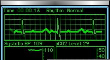 Life and Death EKG Blank Meme Template