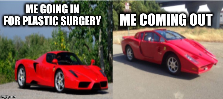 ME GOING IN FOR PLASTIC SURGERY; ME COMING OUT | image tagged in ferrari,memes | made w/ Imgflip meme maker