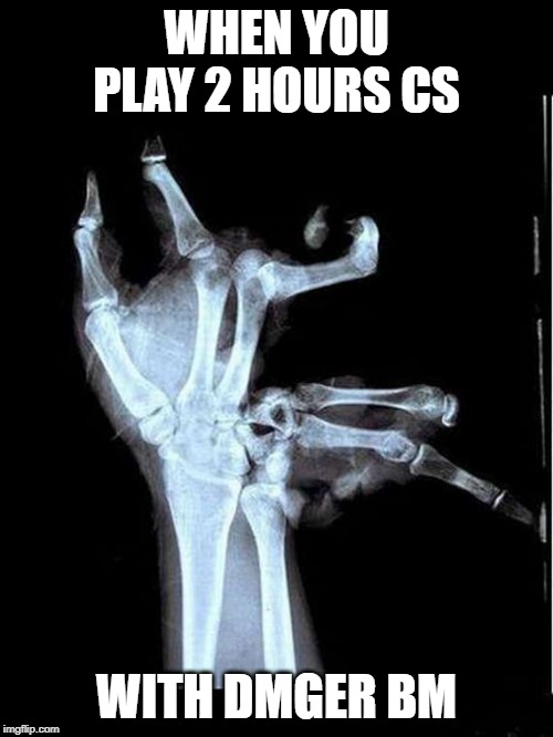 Broken Hand | WHEN YOU PLAY 2 HOURS CS; WITH DMGER BM | image tagged in broken hand | made w/ Imgflip meme maker