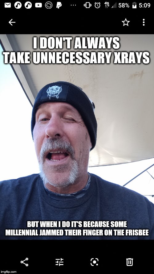 I DON'T ALWAYS TAKE UNNECESSARY XRAYS; BUT WHEN I DO IT'S BECAUSE SOME MILLENNIAL JAMMED THEIR FINGER ON THE FRISBEE | image tagged in xray | made w/ Imgflip meme maker
