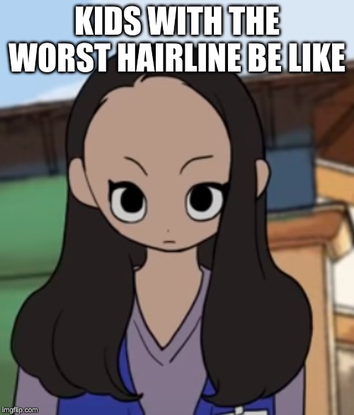 worst hairline