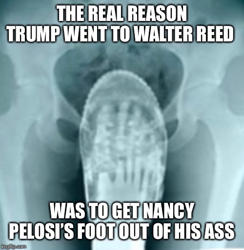 THE REAL REASON TRUMP WENT TO WALTER REED; WAS TO GET NANCY PELOSI’S FOOT OUT OF HIS ASS | image tagged in trump xray,trump pelosi meme,nancy foot trumps ass,impeach trump,trump walter reed meme,trump impeachment | made w/ Imgflip meme maker