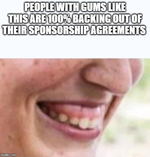 big gums | PEOPLE WITH GUMS LIKE THIS ARE 100% BACKING OUT OF THEIR SPONSORSHIP AGREEMENTS | image tagged in big gums | made w/ Imgflip meme maker