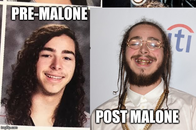 What happened to post malone? | PRE-MALONE; POST MALONE | image tagged in post malone | made w/ Imgflip meme maker