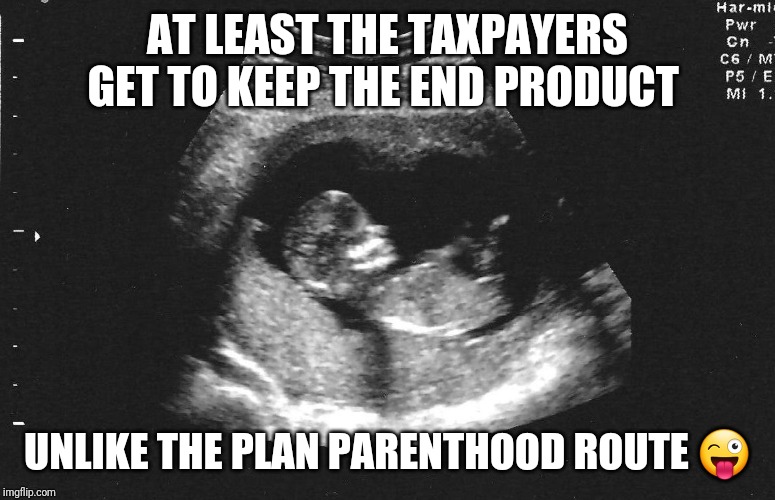 Ultrasound babby | AT LEAST THE TAXPAYERS GET TO KEEP THE END PRODUCT UNLIKE THE PLAN PARENTHOOD ROUTE ? | image tagged in ultrasound babby | made w/ Imgflip meme maker