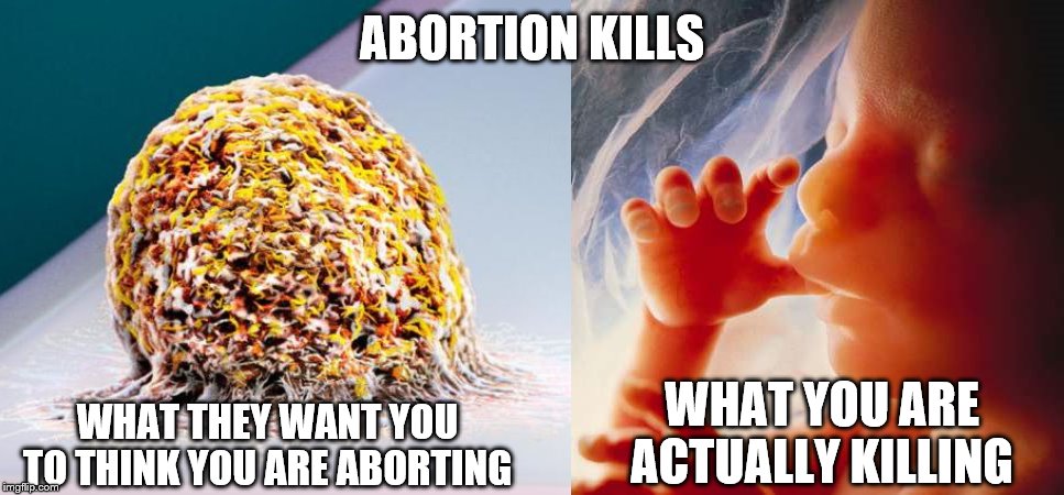 The most precious and most vulnerable has no voice | ABORTION KILLS; WHAT THEY WANT YOU TO THINK YOU ARE ABORTING; WHAT YOU ARE ACTUALLY KILLING | image tagged in fetus,memes,politics | made w/ Imgflip meme maker