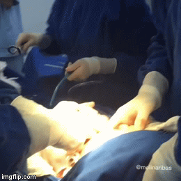 image tagged in gifs,childbirth,baby,birth,c-section,boy | made w/ Imgflip video-to-gif maker