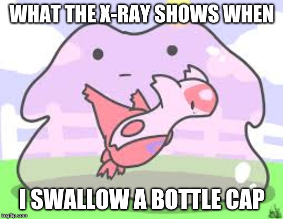 actually happened | WHAT THE X-RAY SHOWS WHEN; I SWALLOW A BOTTLE CAP | image tagged in adhd,x-ray | made w/ Imgflip meme maker