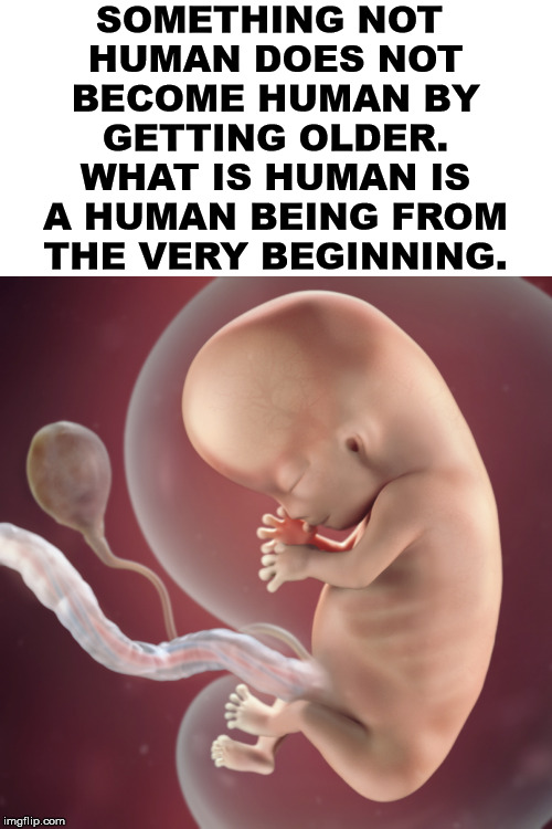 From the initial conception, the cells can only grow into a human being therefore it is always human. | SOMETHING NOT 
HUMAN DOES NOT BECOME HUMAN BY GETTING OLDER. WHAT IS HUMAN IS A HUMAN BEING FROM THE VERY BEGINNING. | image tagged in 10 week fetus,pro life,babies,life | made w/ Imgflip meme maker