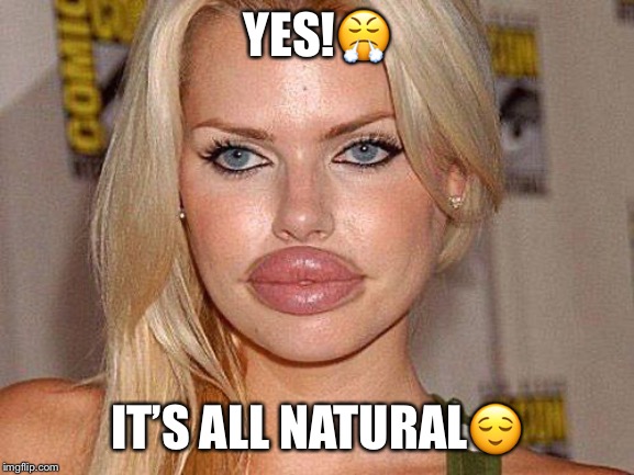 Big Lips |  YES!😤; IT’S ALL NATURAL😌 | image tagged in big lips | made w/ Imgflip meme maker