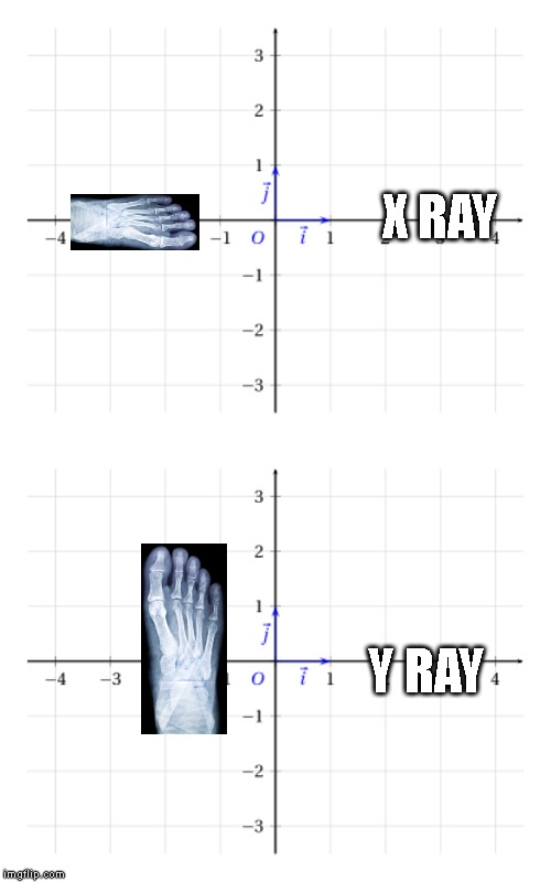 X ray | X RAY; Y RAY | image tagged in new meme,xray,first world problems | made w/ Imgflip meme maker