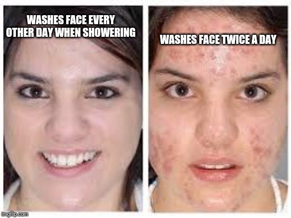 Am I the only one who this happens to? | WASHES FACE TWICE A DAY; WASHES FACE EVERY OTHER DAY WHEN SHOWERING | image tagged in before and after acne meme | made w/ Imgflip meme maker