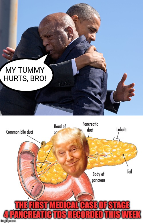 Rep. John Lewis (D) has made medical history | MY TUMMY HURTS, BRO! THE FIRST MEDICAL CASE OF STAGE 4 PANCREATIC TDS RECORDED THIS WEEK | image tagged in john lewis,democrat,cancer,medical,trump derangement syndrome,butthurt liberals | made w/ Imgflip meme maker