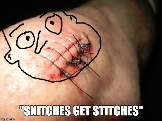 "SNITCHES GET STITCHES" | image tagged in lol so funny,funny meme,funny memes,bad humor,funny,bad pun | made w/ Imgflip meme maker