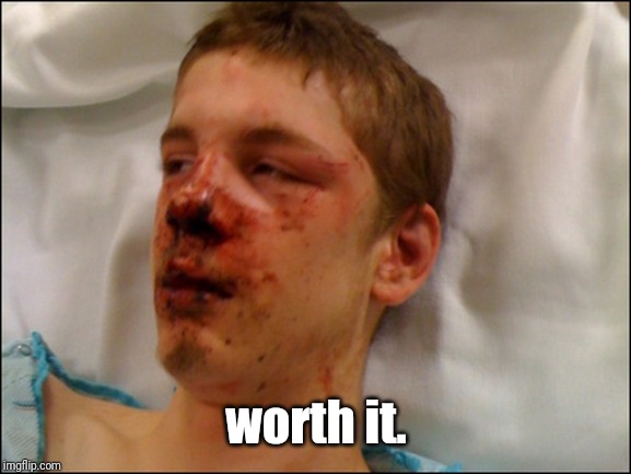 beat up guy | worth it. | image tagged in beat up guy | made w/ Imgflip meme maker