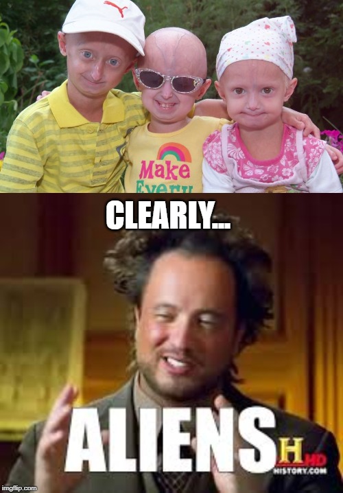 Damn That's Cruel | CLEARLY... | image tagged in progeria,ancient aliens guy | made w/ Imgflip meme maker