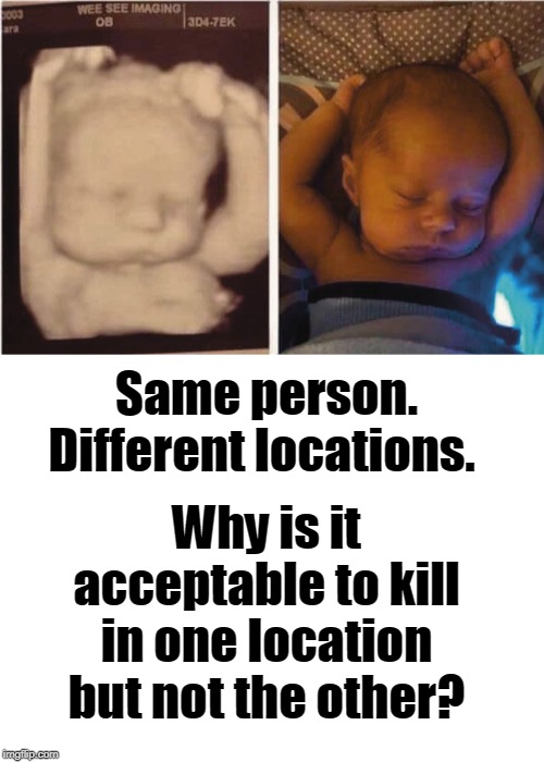 Same person. Different locations. Serious question. | Same person. Different locations. Why is it acceptable to kill in one location but not the other? | image tagged in newborn,ultrasound,abortion,pro choice,pro life,memes | made w/ Imgflip meme maker