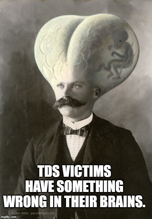 tds | TDS VICTIMS HAVE SOMETHING WRONG IN THEIR BRAINS. | image tagged in tds | made w/ Imgflip meme maker