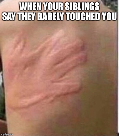 WHEN YOUR SIBLINGS SAY THEY BARELY TOUCHED YOU | image tagged in ouch | made w/ Imgflip meme maker