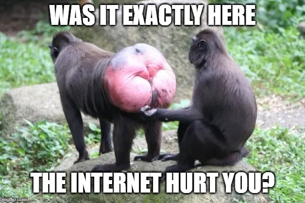 internet butthurt | WAS IT EXACTLY HERE; THE INTERNET HURT YOU? | image tagged in butt,hurt,butthurt,internet | made w/ Imgflip meme maker