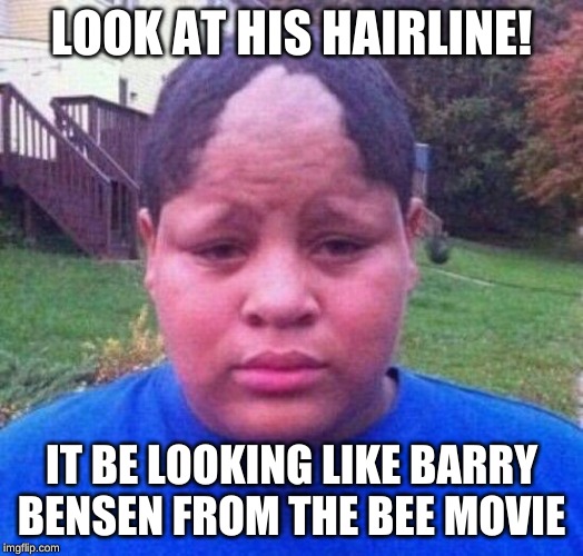 Bad hairline | LOOK AT HIS HAIRLINE! IT BE LOOKING LIKE BARRY BENSEN FROM THE BEE MOVIE | image tagged in bad hairline | made w/ Imgflip meme maker