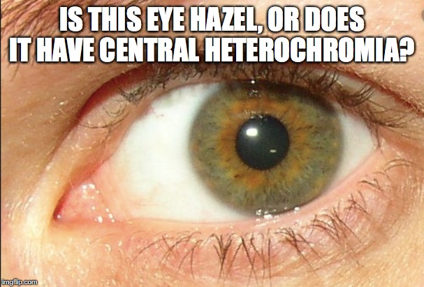 IS THIS EYE HAZEL, OR DOES IT HAVE CENTRAL HETEROCHROMIA? | made w/ Imgflip meme maker