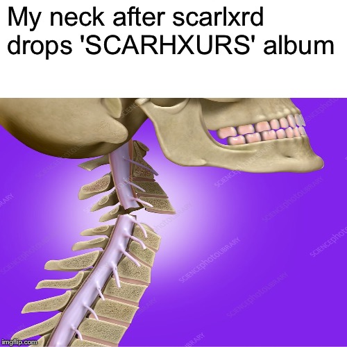 Be headbanging hard! Lxve yxu scarlxrd! I'm yxur biggest fan! | My neck after scarlxrd drops 'SCARHXURS' album | image tagged in memes,scar,death metal | made w/ Imgflip meme maker