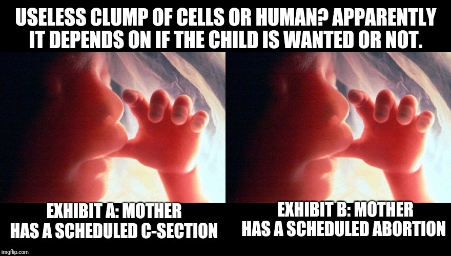 Maybe the Libs here can explain the difference.  I see none. Change my mind: There is no justification for abortion. | USELESS CLUMP OF CELLS OR HUMAN? APPARENTLY IT DEPENDS ON IF THE CHILD IS WANTED OR NOT. EXHIBIT A: MOTHER HAS A SCHEDULED C-SECTION; EXHIBIT B: MOTHER HAS A SCHEDULED ABORTION | image tagged in abortion | made w/ Imgflip meme maker