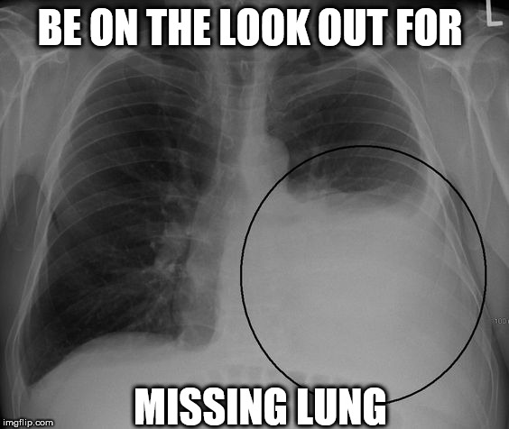 lung | BE ON THE LOOK OUT FOR; MISSING LUNG | image tagged in lung | made w/ Imgflip meme maker