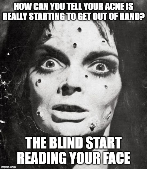 Face Messages | HOW CAN YOU TELL YOUR ACNE IS REALLY STARTING TO GET OUT OF HAND? THE BLIND START READING YOUR FACE | image tagged in pimples | made w/ Imgflip meme maker