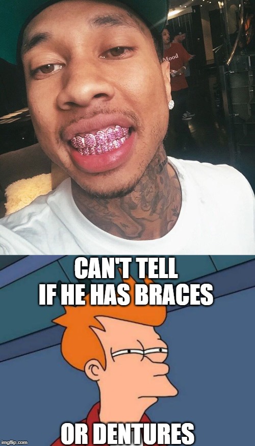 CAN'T TELL IF HE HAS BRACES; OR DENTURES | image tagged in memes,futurama fry | made w/ Imgflip meme maker