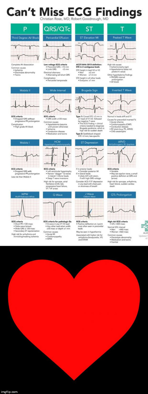 image tagged in heart,ekg | made w/ Imgflip meme maker