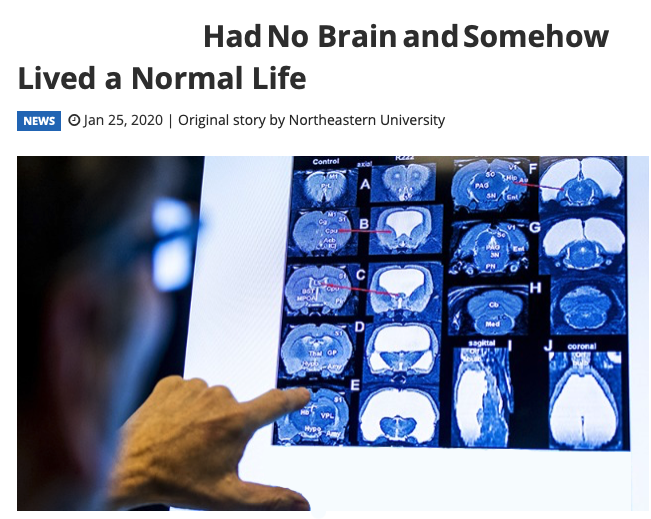 No Brain, Normal Life Blank Meme Template