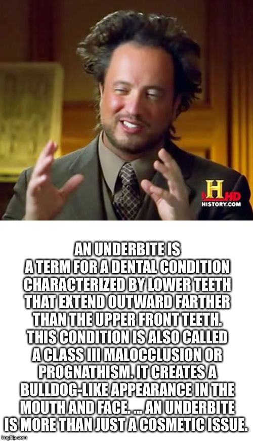 Aliens Guy | AN UNDERBITE IS A TERM FOR A DENTAL CONDITION CHARACTERIZED BY LOWER TEETH THAT EXTEND OUTWARD FARTHER THAN THE UPPER FRONT TEETH. THIS COND | image tagged in aliens guy | made w/ Imgflip meme maker