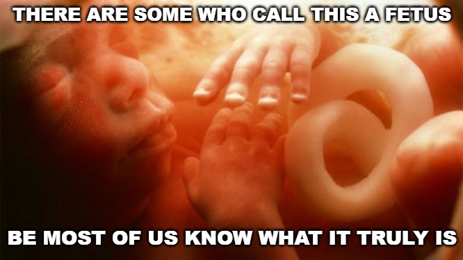 Is it murder? Is it destroying a life? Is it simply getting rid of a bunch of  cells with no feelings or pain? | THERE ARE SOME WHO CALL THIS A FETUS; BE MOST OF US KNOW WHAT IT TRULY IS | image tagged in memes,fetus,baby,womb,abortion | made w/ Imgflip meme maker