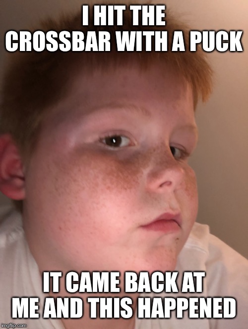 That Hurt | I HIT THE CROSSBAR WITH A PUCK; IT CAME BACK AT ME AND THIS HAPPENED | image tagged in ouch | made w/ Imgflip meme maker
