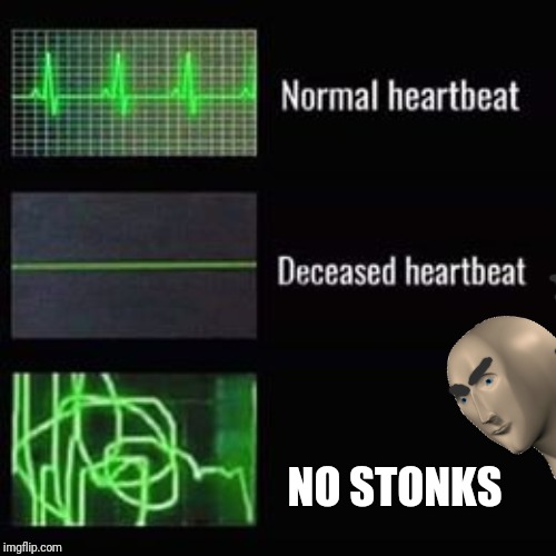 heartbeat rate | NO STONKS | image tagged in heartbeat rate | made w/ Imgflip meme maker