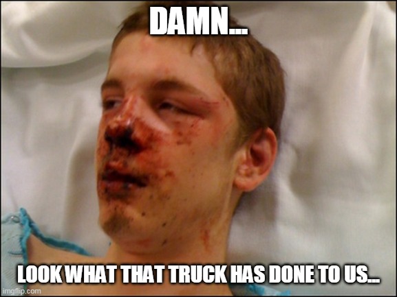 beat up guy | DAMN... LOOK WHAT THAT TRUCK HAS DONE TO US... | image tagged in beat up guy | made w/ Imgflip meme maker