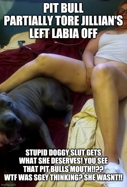 PIT BULL PARTIALLY TORE JILLIAN'S LEFT LABIA OFF; STUPID DOGGY SLUT GETS WHAT SHE DESERVES! YOU SEE THAT PIT BULLS MOUTH!!?? WTF WAS SGEY THINKING? SHE WASNT!! | image tagged in jillian quist is such a gangster for dog dick | made w/ Imgflip meme maker