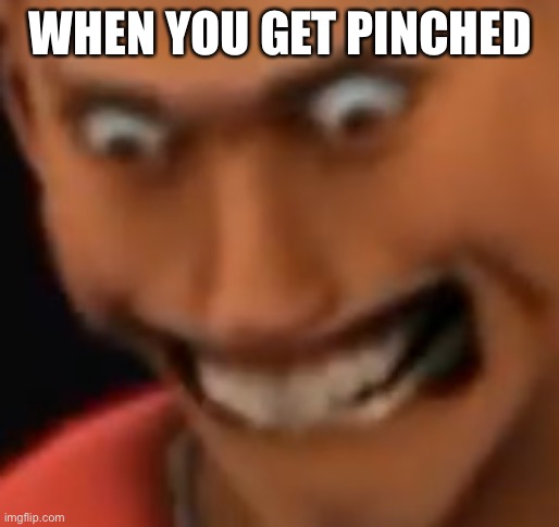 A N G E R | WHEN YOU GET PINCHED | image tagged in a n g e r | made w/ Imgflip meme maker
