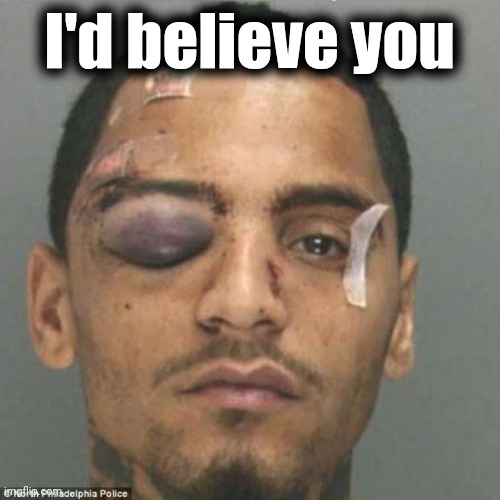 Black Eye | I'd believe you | image tagged in black eye | made w/ Imgflip meme maker