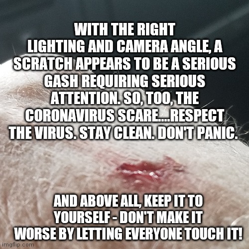 Toilet paper won't help | WITH THE RIGHT LIGHTING AND CAMERA ANGLE, A SCRATCH APPEARS TO BE A SERIOUS GASH REQUIRING SERIOUS ATTENTION. SO, TOO, THE CORONAVIRUS SCARE....RESPECT THE VIRUS. STAY CLEAN. DON'T PANIC. AND ABOVE ALL, KEEP IT TO YOURSELF - DON'T MAKE IT WORSE BY LETTING EVERYONE TOUCH IT! | image tagged in original meme,memes,scaredy cat,coronavirus,corona virus,virus | made w/ Imgflip meme maker