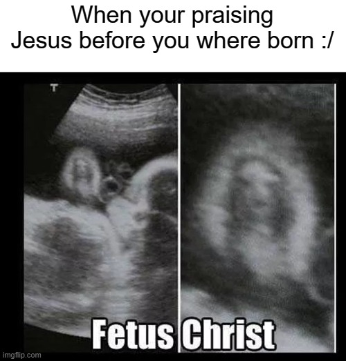 if your christian,then your gonna like this :) |  When your praising Jesus before you where born :/ | image tagged in ultrasound,jesus christ | made w/ Imgflip meme maker