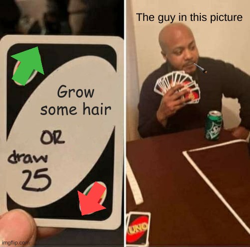 Seriously This Guy Needs Some Hair | The guy in this picture; Grow some hair | image tagged in memes,uno draw 25 cards,funny memes,funny,dank memes,original meme | made w/ Imgflip meme maker