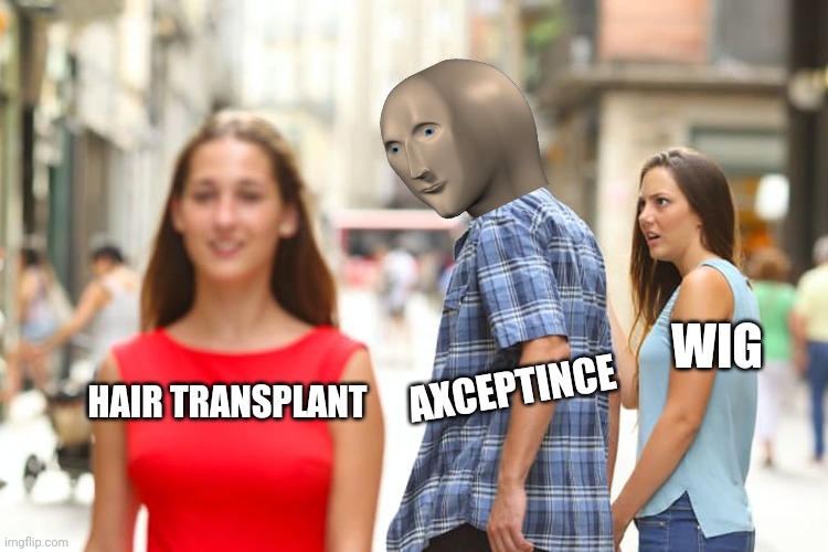 Distracted Boyfriend | AXCEPTINCE; WIG; HAIR TRANSPLANT | image tagged in memes,distracted boyfriend | made w/ Imgflip meme maker