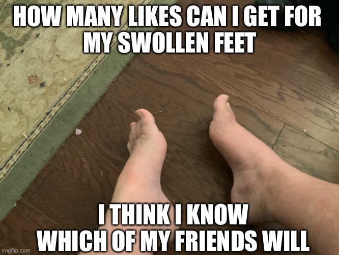 Boomer Alert | HOW MANY LIKES CAN I GET FOR 
MY SWOLLEN FEET; I THINK I KNOW WHICH OF MY FRIENDS WILL | image tagged in boomer post | made w/ Imgflip meme maker